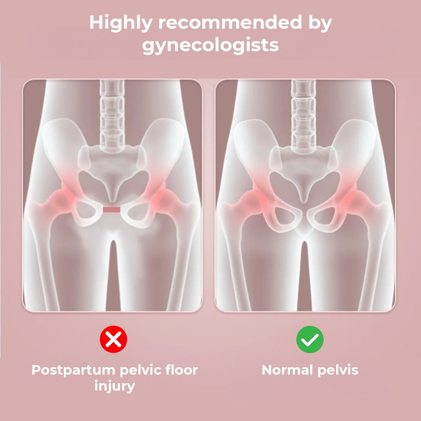 Pelvic Floor Exerciser